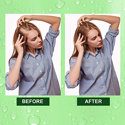 Olio di Rosmarino per Capelli 60ml, Olio Essenziale Rosmarino, Olio Rosmarino Capelli biologico di grado terapeutico per la crescita dei capelli (60ml) - 8earn